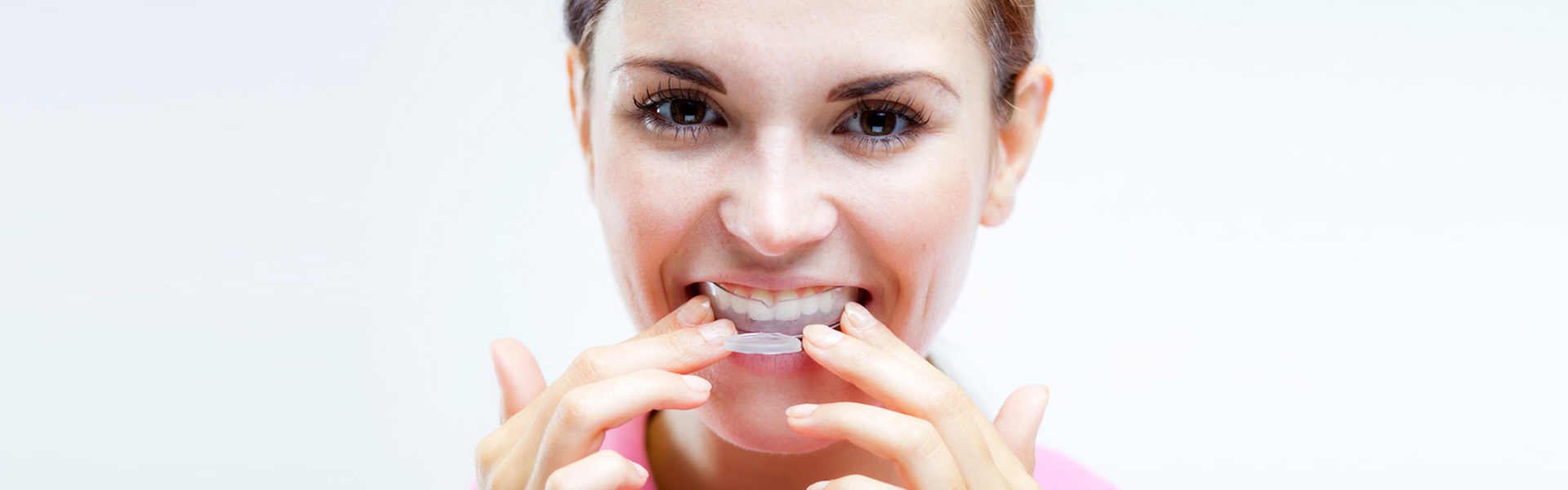 5 Good Reasons To Use Athletic Mouth Guards For Braces