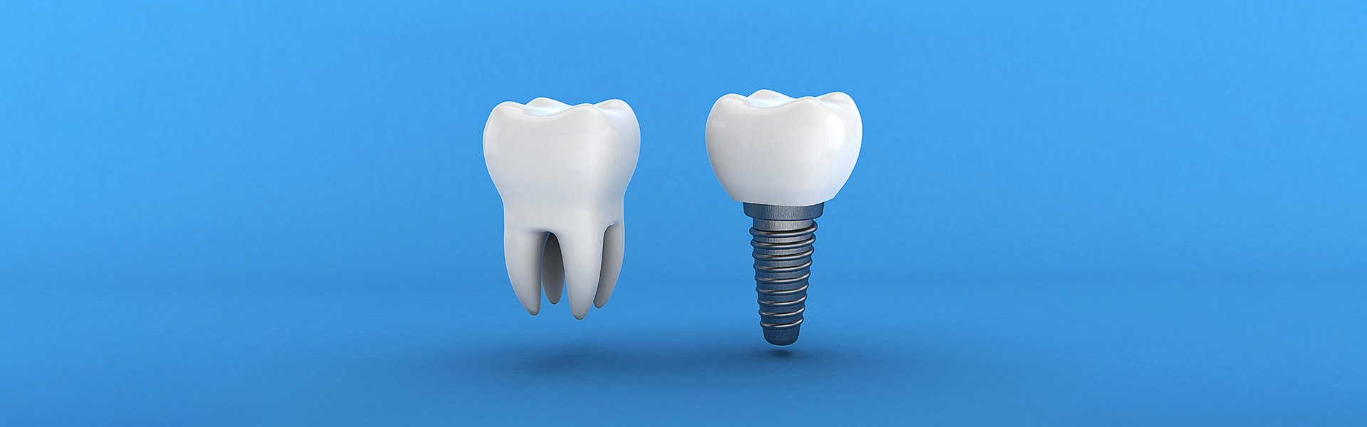 After Tooth Extraction How Long Must You Wait before Getting Tooth Replacements