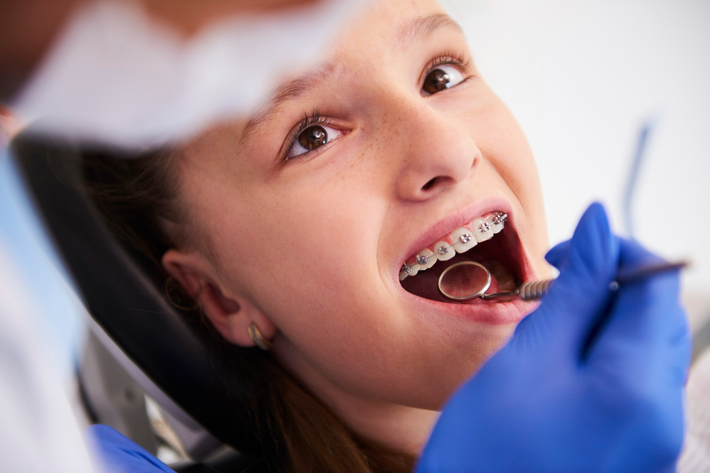 Navigating Orthodontic Options: Braces, Invisalign, and Beyond