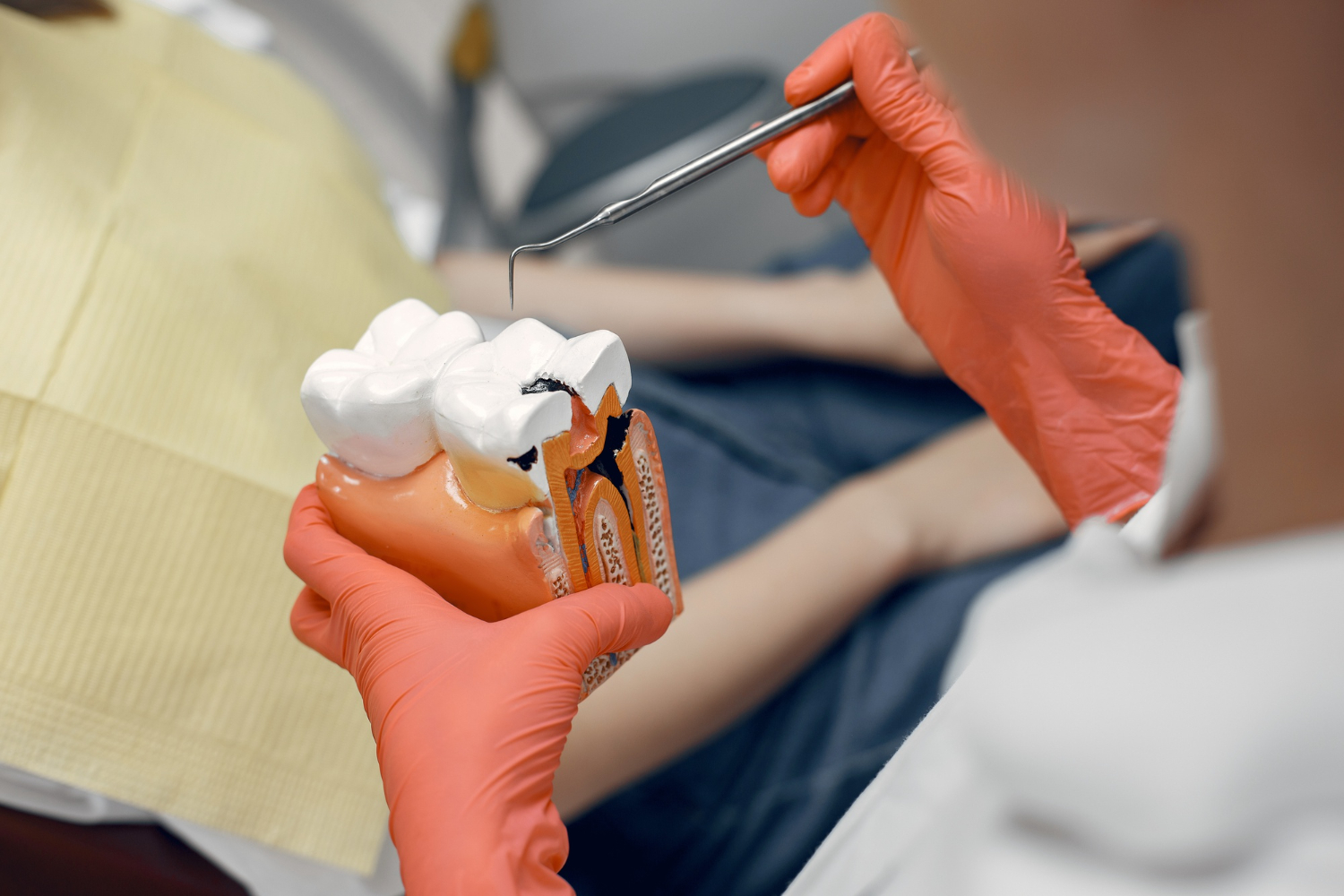 Addressing Cavities: The Urgency of Timely Dental Care