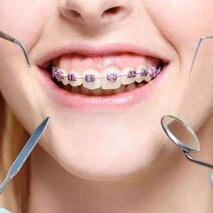 Family Orthodontics